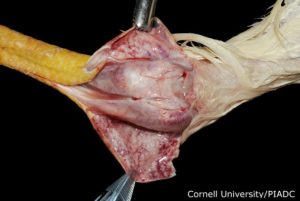 Acute edema and congestion