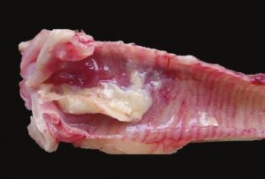 Edema and hemorrhage and caseous exudate in trachea