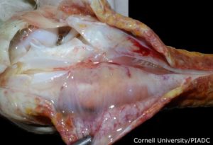 Subcutaneous tissue (leg): acute diffuse edema