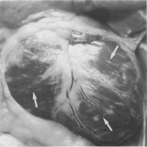 میوکاردیت در سگ مبتلا به عفونت پاروویروسی نقاط و خطوط سفید رنگ در عضله قلب با فلش مشخص گردیده که اصطلاحاً به آن قلب ببری یا Tiger heart نیز گفته می شود