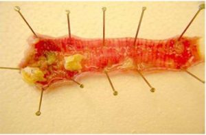 Wet pox lesions in tracheal