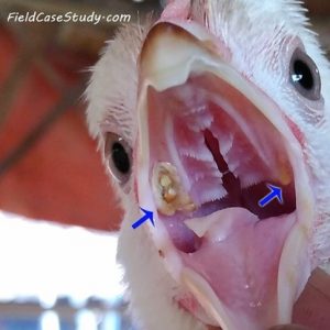 Diphtheritic (wet pox) form (inner mouth)