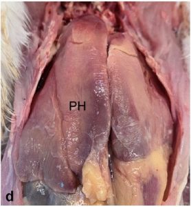 Perihepatitis with a fibrinous perihepatitis