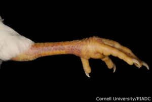 Hemorrages (Leg) ,Edma (Foot)