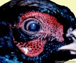 Lense:Locally extensive Cataract