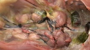 swollen, dilation of renal tubules are with urates