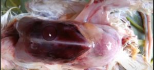 sever hemorrhages in breast muscles