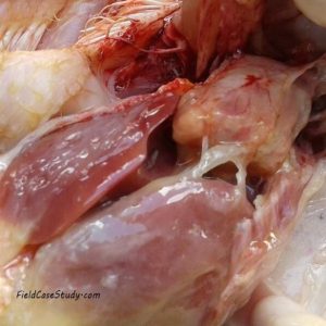 Pericarditis, Perihepatitis, Airscaculaitis and fibrinopurulent