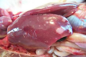 ایجاد تومور در کبد (liver tumor)